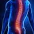 Clinical-Trials-Underway-for-New-Treatment-for-Lumbar-Spinal-Stenosis-Patients